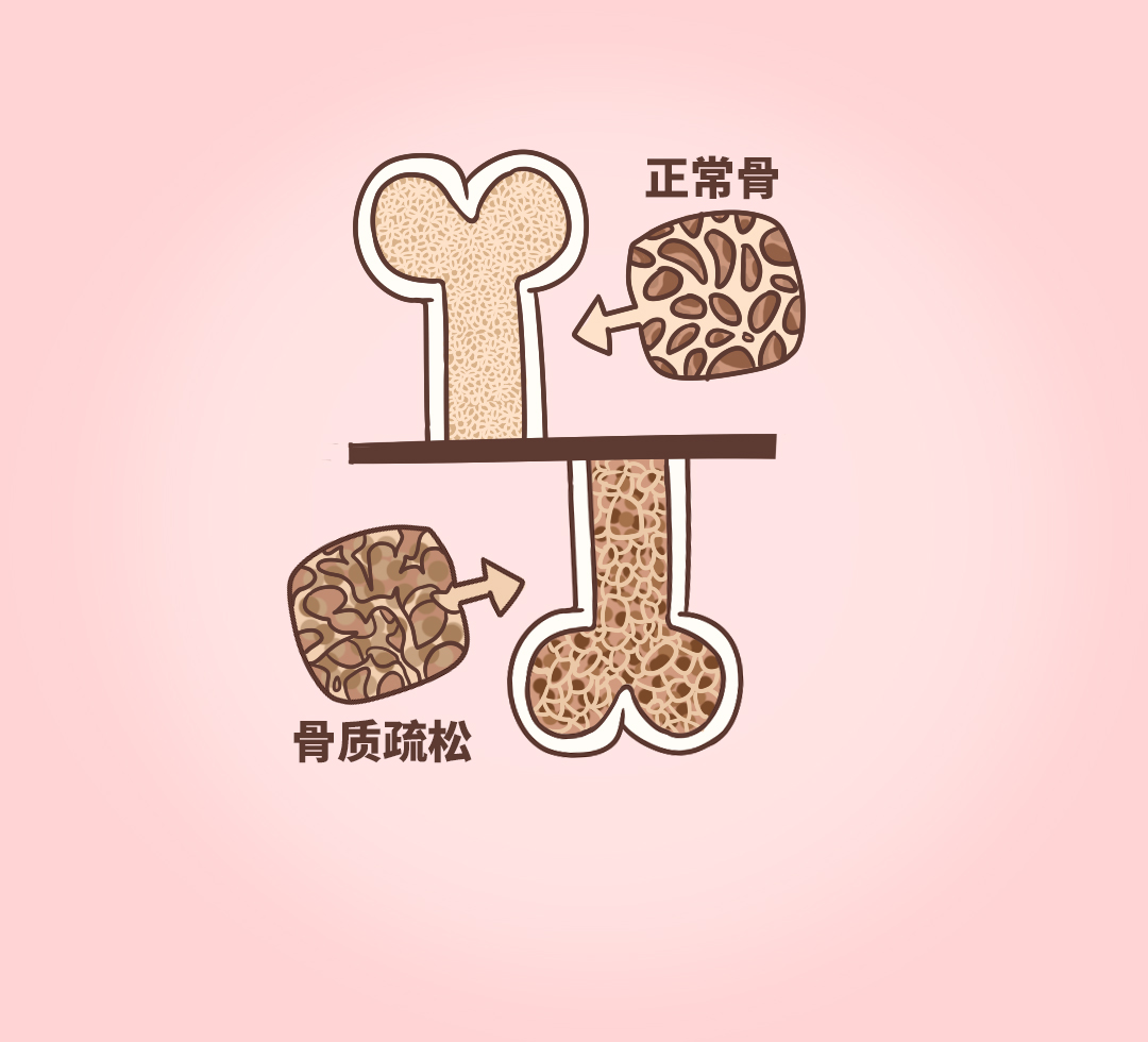 AWC_